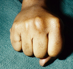 boxers-knuckle.jpg